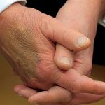 تلاش ترامپ برای پنهان کردن کبودی روی دستش جنجالی شد