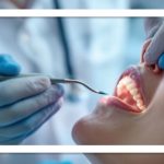 روشهای بلیچینگ دندان و مراقبتهای ضروری قبل و بعد از آن روشهای بلیچینگ دندان و مراقبتهای ضروری قبل و بعد از آن