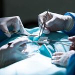 دستگیری دکتر قلابی حین عمل لیپوساکشن در منزل دستگیری دکتر قلابی حین عمل لیپوساکشن در منزل