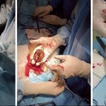 خرمالو 6 نفر را به بیمارستان کشاند خرمالو 6 نفر را به بیمارستان کشاند