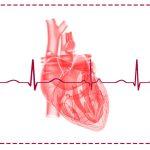 درمان نوین آریتمی قلبی با پالس الکتریکی؛ آغاز عصر جدیدی در پزشکی ایران