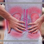 چکاپ منظم؛ راهکار طلایی پیشگیری از بیماری‌های کلیوی