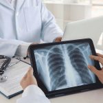 آلودگی هوا و دخانیات؛ دو عامل اصلی تهدیدکننده سلامت ریهها آلودگی هوا و دخانیات؛ دو عامل اصلی تهدیدکننده سلامت ریهها