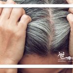 طب سنتی و علت سفیدی موها طب سنتی و علت سفیدی موها