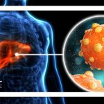 هر آنچه لازم است در مورد هپاتیت بدانید هر آنچه لازم است در مورد هپاتیت بدانید