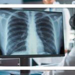 هوش مصنوعی از روی عکس رادیولوژی پوکی استخوان را تشخیص میدهد هوش مصنوعی از روی عکس رادیولوژی پوکی استخوان را تشخیص میدهد