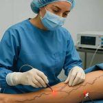 واریس پا چیست و آشنایی با اسکلروتراپی یا تزریق واریس