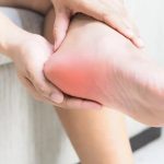 عوامل مؤثر بر بروز خار پاشنه؛ چرا این عارضه ایجاد میشود؟ عوامل مؤثر بر بروز خار پاشنه؛ چرا این عارضه ایجاد میشود؟