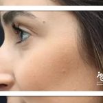 چرا بینی قوز دار مد 2026 شد چرا بینی قوز دار مد 2026 شد