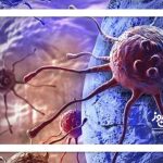 هر توموری سرطانی نیست – سلامت نیوز هر توموری سرطانی نیست – سلامت نیوز