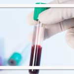 بالا بودن تعداد پلاکت خون می‌تواند منجر به مشکلات جدی سلامتی شود؟