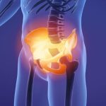 چرا برخی دردهای لگنی هرگز نباید نادیده گرفته شوند؟