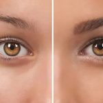 کاشت ابرو در مشهد ؛ انتخابی که می‌تواند چهره و اعتماد به‌ نفس را متحول کند