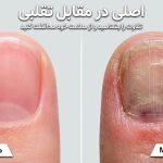 عوارض خاموش و هولناک مواد تقلبی کاشت ناخن؛ هشدار جدی به بانوان و ناخن‌کاران