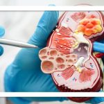 گرمای شدید و سرمای افراطی، دشمن پنهان کلیهها گرمای شدید و سرمای افراطی، دشمن پنهان کلیهها