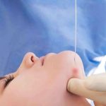 اندولیفت برای لاغری و جوانسازی دروغه یا واقعیت داره؟ اندولیفت برای لاغری و جوانسازی دروغه یا واقعیت داره؟