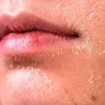 ۵ روش برای مراقبت از پوست در زمستان/ با این چند روش ساده پوست براق و لطیف داشته باشید ۵ روش برای مراقبت از پوست در زمستان/ با این چند روش ساده پوست براق و لطیف داشته باشید