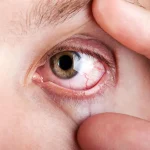 راهکارهای طلایی برای جلوگیری از خشکی چشم در هوای سرد زمستان راهکارهای طلایی برای جلوگیری از خشکی چشم در هوای سرد زمستان