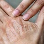 تأثیر عجیب آلودگی هوا بر پیری پوست