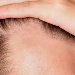 رشد ۵۳۹ درصدی مو با داروی جدید؛ خداحافظی با طاسی سر؟