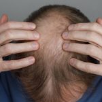 پایان کابوس طاسی؛ گیاه باستانی چینی کلید درمان قطعی ریزش مو شد